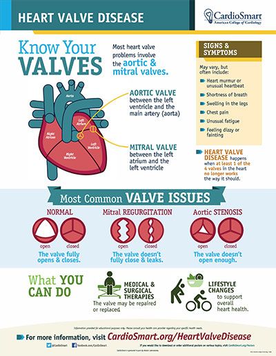 Mitral Valve Stenosis, Heart Valves Mnemonics, Valve Disorders Nursing, Heart Valve Replacement, Heart Valve Disorders, Aortic Regurgitation, Mitral Regurgitation, Aortic Valve Stenosis, Mitral Stenosis