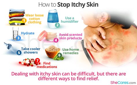 #Shecares #itchyskin When skin begins itching, it can be difficult to get it to stop. A number of different factors can cause skin to itch, and luckily, there are many ways to take control of the situation again. Particular lifestyle changes can reduce the chances of itchy skin, as well as methods that can stop itchy skin once it begins. How To Stop Itching Skin, Itchy Legs, Bug Bite, Skin Allergy, Itching Skin, Hormonal Imbalance, Skin Allergies, A Bug, Cotton Clothing