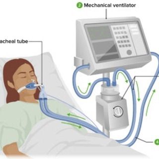 Mechanical ventilation is a critical component of modern healthcare, providing life-saving support to patients who cannot breathe adequately on their own. For nursing professionals, mastering the principles and practices of mechanical ventilation is essential, especially when preparing for the NCLEX exam. This guide will cover the fundamental aspects of mechanical ventilation, including basic principles, modes, settings, monitoring, complications, nursing considerations, and study resources. ... Nclex Exam, Mechanical Ventilation, Professional Nurse, Study Resources, Nclex, Saving Lives, Nursing, Health Care, Medical