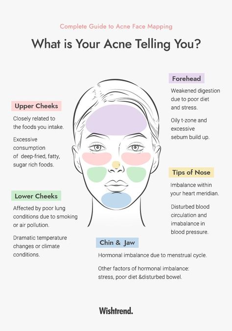 What Different Areas Of Acne Mean, Reasons Why You Have Acne, What Does Acne On Your Forehead Mean, Placement Of Pimples Meaning, What Does Ur Acne Mean, What My Acne Is Telling Me, Why Acne Is Where It Is, Where Ur Acne Is Meaning, What Is Causing My Acne