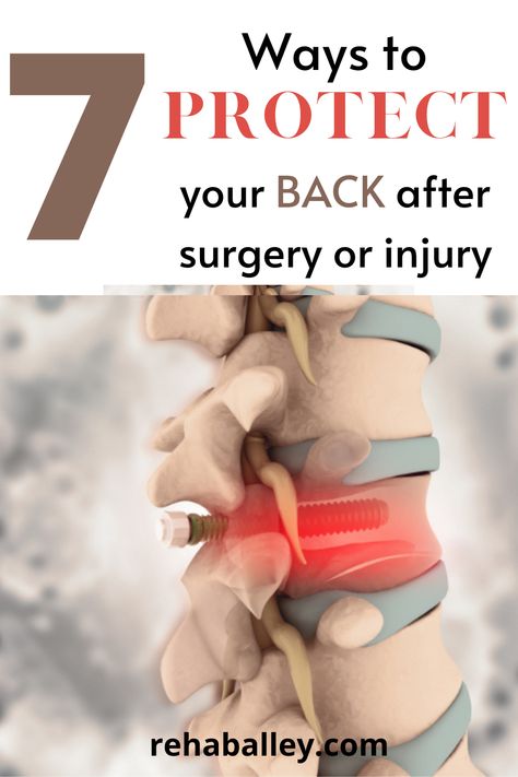 This picture displays a human spine with a screw going through it. This can be used as an example of a back surgery. Post Spinal Fusion Workout, Lumbar Surgery Recovery, Herniated Disk Surgery Recovery, Lower Back Injury Recovery, Back Injury Recovery, Back Strengthening Exercises After Surgery, Back Injury Exercises Recovery, Back Injury Exercises, Lower Back Injury Workout