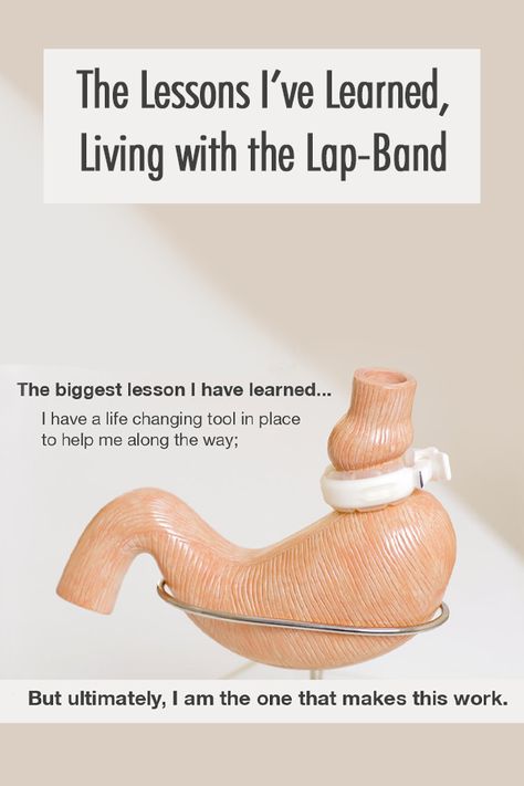 Gastric Band Diet, Lapband Diet Plan, Lap Band Recipes, Lap Band Before And After, Lap Band Diet Plan, Band Problems, Gastric Problem, Lap Band, Gastric Band