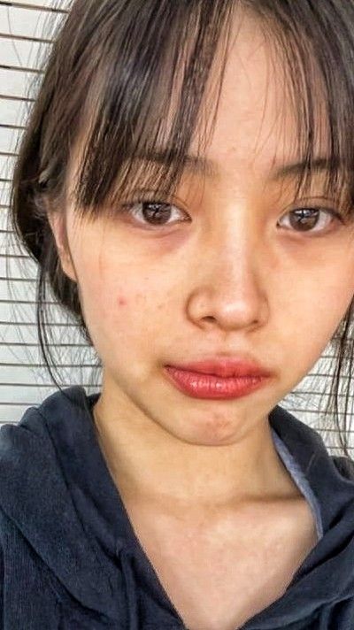 Girl With Acne, Real Skin, Shin Ryujin, Jennie Kim Blackpink, Real Beauty, Kpop Fashion, Korean Beauty, Girl Crush, Ulzzang Girl