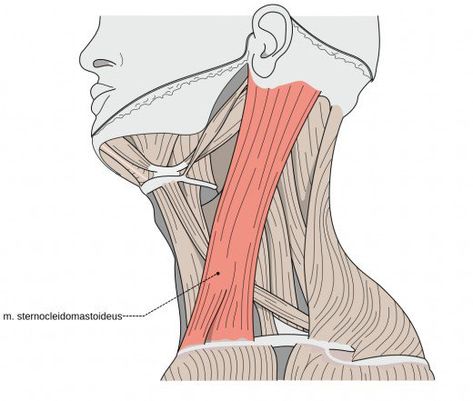 Forehead Headache, Neck Muscle Anatomy, Sternocleidomastoid Muscle, Piriformis Stretch, Forward Head Posture, Muscle Rub, Eye Pain, Chronic Cough, Head Pain