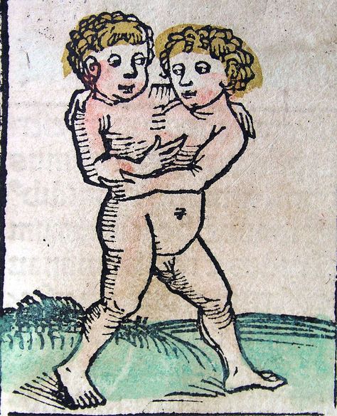 Crap speaks to crap: Conjoined twins in liturgical music Nuremberg Chronicle, Siamese Twins, Twin Tattoos, Medieval Drawings, Medieval Artwork, Conjoined Twins, Medieval Manuscript, Mystical Art, Medieval Art