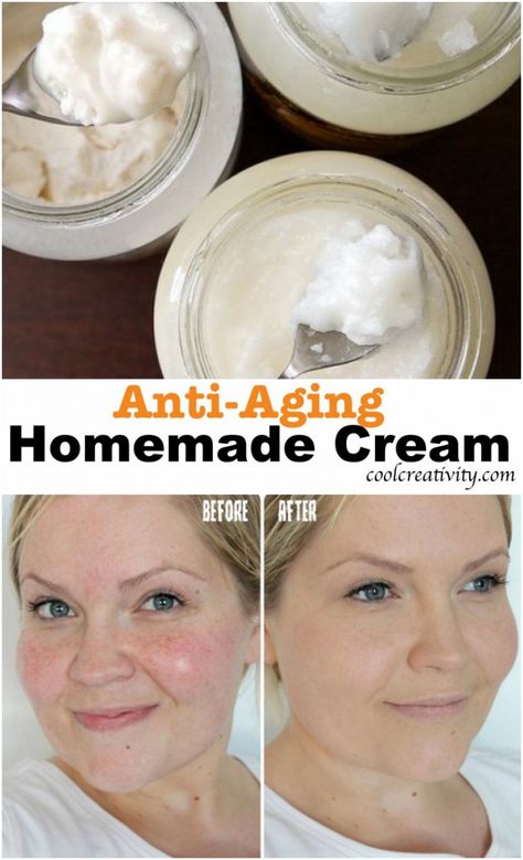 Simple Ingredients for Homemade Anti-Aging Cream Anti Aging Face Mask Diy, Homemade Anti Wrinkle Cream, Diy Anti Aging Cream, Anti Aging Homemade, Homemade Wrinkle Cream, Lotion For Oily Skin, Tips For Oily Skin, Oily Skin Acne, Cream For Oily Skin