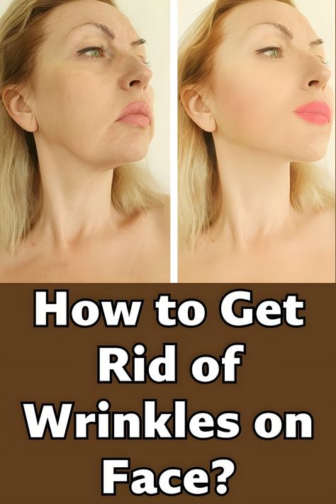 How She Got Rid of Wrinkles Without Botox! Skin Care For Dark Spots, Skincare For Wrinkles, Wrinkles On Face, Glow Up Skin, Dark Spots Remedies, Wrinkles Remedies, Wrinkle Remedies, Skincare Remedies, Wrinkle Free Skin