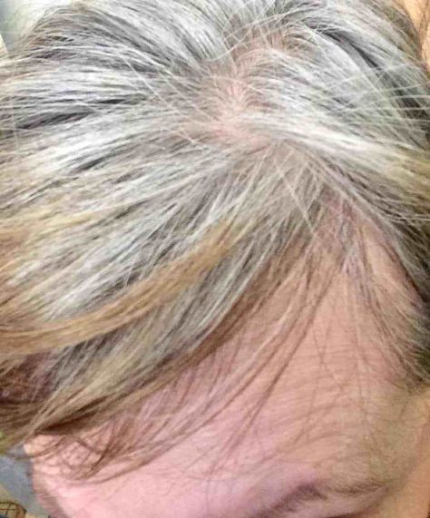 Beginner's Guide | 3 Stages Growing Out Grey Hair - Cedarbirch Musings Easy To Grow Out Highlights, What To Do When Hair Is Turning Gray, Grey Hair Growing Out From Brown, How To Reverse Grey Hair Naturally, Grey Hair Turning Yellow, Dark Brown Hair Dye, Grey Brown Hair, Grey Roots, Gray Hair Growing Out