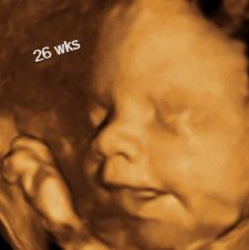 Clear 3D/4D Ultrasounds OBaby! Murfreesboro, TN 26 weeks Pregnancy By Month, 5th Month Of Pregnancy, Gender Determination, 3d Ultrasound, 4d Ultrasound, Pregnancy Ultrasound, Ultrasound Pictures, Early Pregnancy, Pregnancy Months