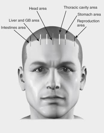 Acupuncture Migraine, Acupressure Headache, Punkty Spustowe, Forward Head Posture Exercises, Neck And Shoulder Muscles, Massage Therapy Techniques, Face Mapping, Therapy Techniques, Acupuncture Points