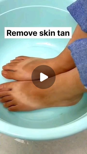 Feet Tanning Removal, Feet Tan Removal Home Remedies, Foot Tan Removal Home Remedies, Feet Cleaning Home Remedies, Feet Cleaning At Home, How To Clean Legs At Home, Pedicure For Tan Skin, How To Remove Sun Tan At Home, Leg Whitening Home Remedies