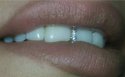 A tooth gap filled with diamonds Grillz For Gap Teeth, Gap Grillz, Pearly White Teeth, Tooth Gap, Girl Grillz, Dental Jewelry, Grillz Teeth, Tooth Filling, Diamond Grillz