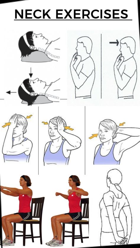 Effective exercise for neck pain and postural defects also good for cervical spondylosis . Cervical Neck Stretches, Exercise For Cervical Neck Pain, Neck Relief Stretches, Cervical Spondylosis Exercises, Neck Exercises For Pain Relief, Cervical Exercises, Cervical Exercise, Spondylosis Exercises, Cervical Pain Exercises