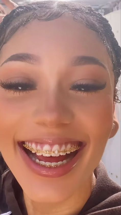 Gold Braces Teeth, Latina With Braces, Tongue Web Piercing, Braces Colors Ideas, Jewelry Teeth, Braces And Glasses, Gold Braces, Girl Grillz, Teeth Gems