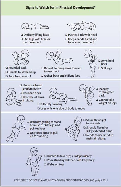 Signs to watch for in your baby's motor development. Contact your pediatrician and ask for an evaluation if you have concerns about you baby's motor development. Pediatric Pt, Pediatric Physical Therapy, Sensory Diet, Occupational Therapy Activities, Pediatric Occupational Therapy, Motor Development, Pediatric Therapy, Developmental Milestones, Speed Reading