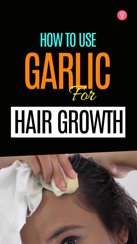 How To Use Garlic For Hair Growth #haircare #hairgrowth Garlic For Hair Growth, Grow Hair Overnight, Onion Hair Growth, Onion For Hair, Vitamins For Hair Growth, Boost Hair Growth, Hair Shedding, Hair Control, Grow Hair Faster