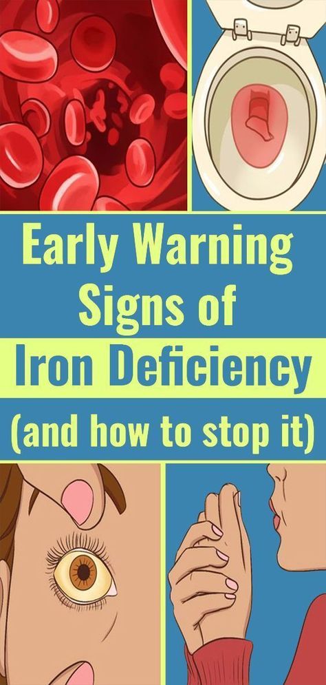 Iron Deficiency Symptoms That You Shouldn’t Ignore Iron Deficiency Symptoms, Signs Of Iron Deficiency, Honey And Lemon Drink, Deficiency Symptoms, Home Medicine, Iron Deficiency, Healthy Brain, Diy Beauty Hacks, Stop It