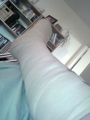 Fracture Snap, Ankle Cast, Ankle Surgery Recovery, Broken Ankle Recovery, Ankle Recovery, Ankle Replacement, Brooke Williams, Long Leg Cast, Ankle Fracture