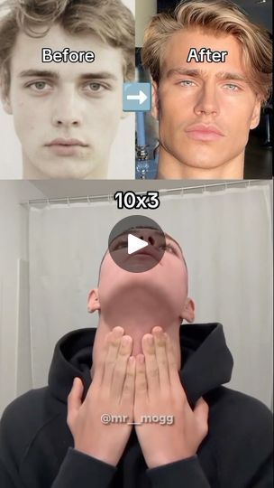 Mouth Exercises, Tongue Posture, Facial Symmetry, Neck Posture, Posture Improvement, Glowup Tips, Nasal Breathing, Mouth Breathing, Dry Mouth