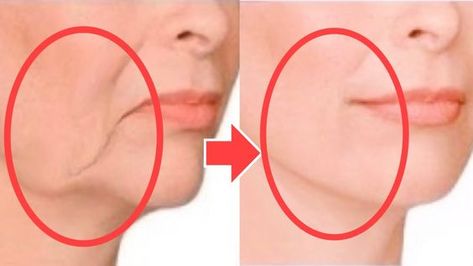 Face Lifting Massage, Face Massage Video, Sagging Jowls, Face Lift Exercises, Face Massage Anti Aging, Sagging Cheeks, Sagging Face, Face Massage Techniques, Facial Massage Routine