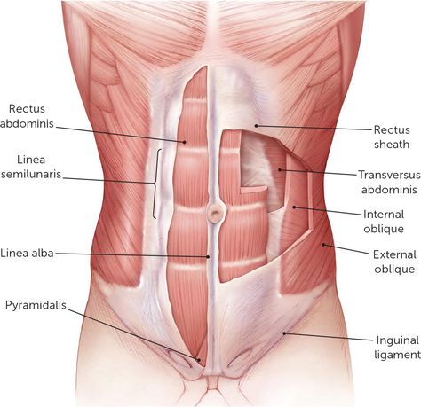 Lower Abdominal Pain, Differential Diagnosis, Referred Pain, Homemade Facial Mask, Muscle Abdominal, Pinched Nerve, Abdominal Surgery, Muscle Anatomy, Patient Education