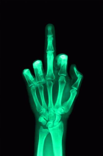 Gothic Homescreen, X Ray Aesthetic, Hump Day Gif, Kesha Aesthetic, Middle Finger Gif, Acid Wallpaper, Finger Wallpaper, Middle Finger Wallpaper, Xray Art