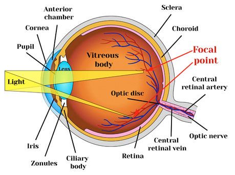 Astigmatism Eye, Eye Health Facts, Headache Diet, Health Ledger, Eye Anatomy, Laser Eye Surgery, Lasik Surgery, Greek Language, Vision Problems