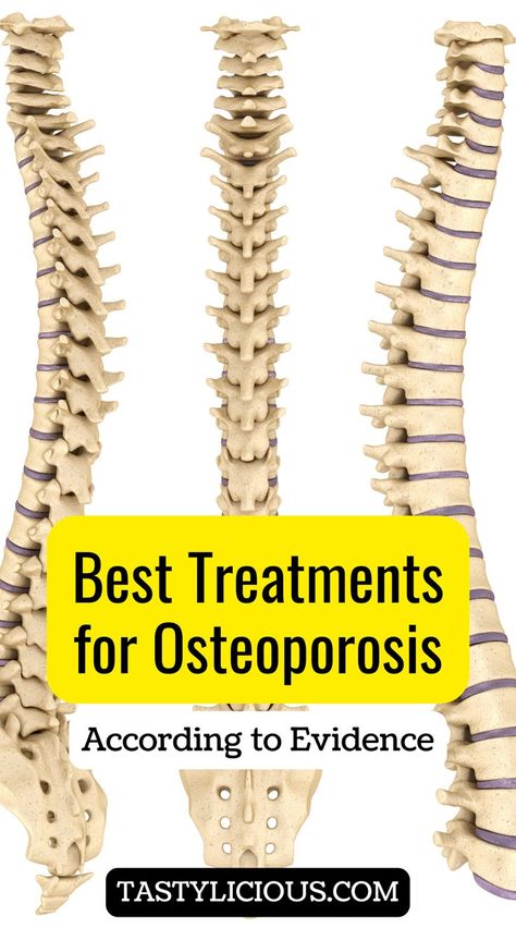 new treatments for osteoporosis | effective treatment for osteoporosis | natural treatments for osteoporosis | best treatments for osteoporosis | juicing recipes for weight loss | juice recipes | healthy juicer recipes | juicer recipes beginners | green juice recipes for weight loss Smoothie For Osteoporosis, Foods For Osteoporosis, Diet For Osteoporosis, Herbs For Osteoporosis, Osteoporosis Diet Recipes, Osteoporosis Diet Plan, Exercise For Osteoporosis For Women, Reverse Osteoporosis, Bone Healing Foods