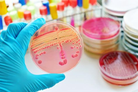 Bacteria Culture, Pseudomonas Aeruginosa, Lung Infection, Periodontal Disease, Gut Bacteria, Health Management, Bacterial Infection, Disease Prevention, Healthy People