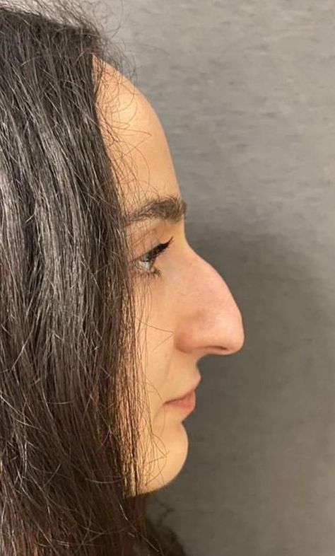 Nose Appreciation, Big Nose Women, Nose Profile, Human Nose, Side Nose, Aquiline Nose, Crooked Nose, Large Nose, Face Portraits