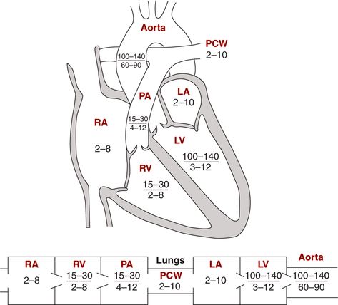 Image: Diagrams indicating normal pressures in the cardiac chambers &… Cath Lab Nursing, Cath Lab Nurse, Cardiac Sonography, Blood Pressure Chart, Cardiac Nursing, Critical Care Nursing, Respiratory Therapy, Nursing Study, Nursing Education