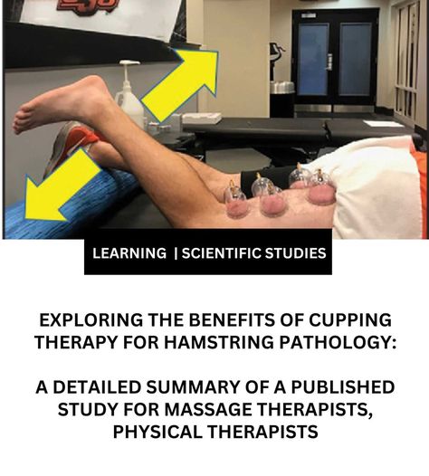 Study Summary: Exploring the Benefits of Cupping Therapy for Hamstring Pathology Benefits Of Cupping, Sports Physical Therapy, Hamstring Muscles, Cupping Therapy, Myofascial Release, Self Massage, Leg Pain, Physical Therapist, Massage Therapist