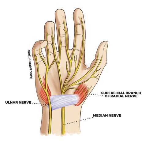 Mr Paul Jarrett | Hand and Wrist Anatomy | Murdoch Orthopaedic Clinic Wrist Muscles Anatomy, Hand Nerves, Wrist Anatomy, Carpal Tunnel Exercises, Nerve Anatomy, Radial Nerve, Hand Anatomy, Ulnar Nerve, Median Nerve