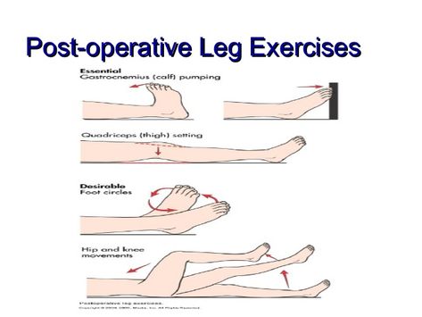 Post-Operative Leg Exercises Perioperative Nursing, Leg Exercise, Leg Exercises, Nursing Care, Nursing Student, Leg Workout, Nursing Students, Love Of My Life, Nursing