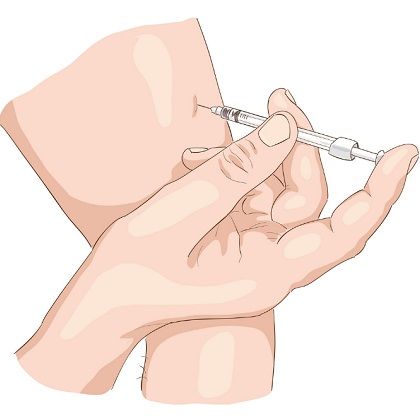 Injection Intramuscular Injection Sites, Insulin Injection, Injection Sites, Hand Pic, Image Illustration, Free Vector Images, Vintage Art, Stock Vector, Vector Images