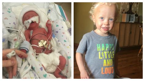 Having a preemie and an extended NICU stay is something (thankfully) few parents can understand. 33 Week Preemie, 28 Week Preemie, Nicu Parents, Prom Dresses Classy, Premature Atrial Contraction, Micro Preemie Clothes, 26 Weeks Pregnant, Micro Preemie, Preemie Babies