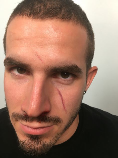 Scar face using rigid collodion Face Scar Tattoo, Scar On Face Sketch, Face Scar Eye, Collodion Scar, Scars On Face Reference Drawing, Scar Face Aesthetic, Facial Scar Reference, Friend Dynamics, Rigid Collodion