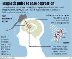 Tms Therapy, Transcranial Magnetic Stimulation, Nerve Cells, Pemf Therapy, Magnet Therapy, Brain Stimulation, Limbic System, Improve Cognitive Function, Health Talk