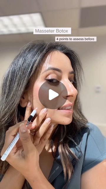 Gurpreet Kaur | NP | Injector | Chapel Hill NC | Botox | Filler on Instagram: "Masseter Botox can help slightly slim down the lower face. If used for the right, Patient , it can lead to a beautiful balance between the features. It can slim down the jawline , improve cheek definition. 
At the same time it’s important to make sure it’s injected on the right person to avoid Jowl heaviness. 
#masseterbotox #injector #botox #lowerfaceslimming #nc" Masseter Botox Injection, Botox Mapping, Masseter Botox Before And After, Botox Injection, Botox Before And After, Botox Filler, Botox Injections, Botox Fillers, Chapel Hill Nc