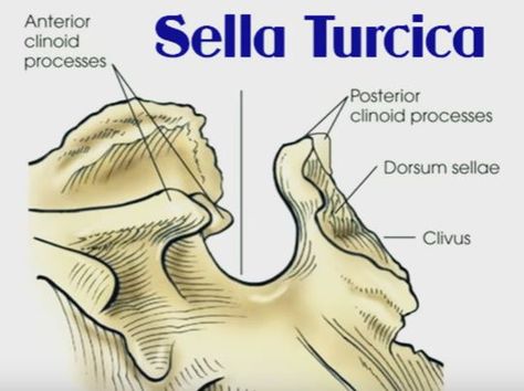 Sphenoid bone- note sella turcica and clivus Sella Turcica, Sphenoid Bone, Gross Anatomy, Radiology Tech, Rad Tech, Lab Tech, Med School, Microbiology, Radiology