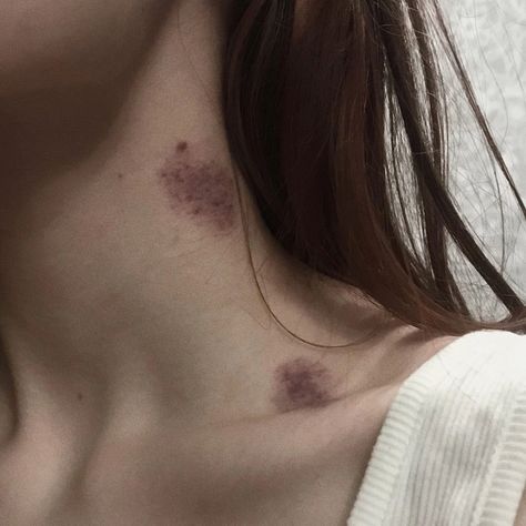 Neck With Love Bites, Hicks On Neck Girl, Neck Bite Mark, Hickey Girls, Love Bites Mark Aesthetic, Hickey Neck Aesthetique, Heart Made Of Hickeys, Love Bite Snap, Love Bites Hickey