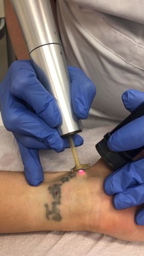 Tattoo Removal Laser, 2024 Lifestyle, Med Spa Marketing, Remove Tattoo, Medical Tools, Spa Marketing, Esthetics Room, Laser Removal, Medical Aesthetics