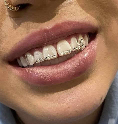 #toothgem #jewelry #trending Diamonds On Teeth Women, Butterfly Grills Teeth, Teeth Diamond Aesthetic, Rine Stone On Teeth, Girl Grillz Aesthetic, Bijoux Piercing Septum, Girl Grillz, Teeth Gems, Jewelry Trending