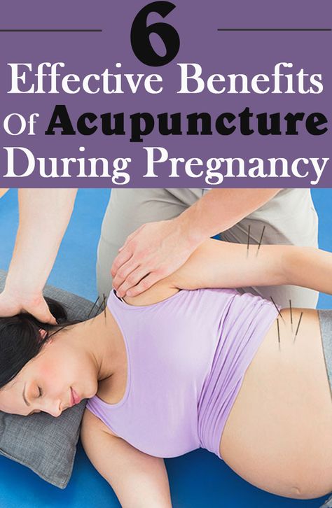 6 Effective Benefits Of Acupuncture During Pregnancy - Momjunction #healthbenefitsacupuncture #acupuncturebenefits #acupunctureduringpregnancy Benefits Of Acupuncture, Acupuncture Benefits, Acupressure Mat, Prenatal Massage, Shiatsu Massage, Pregnancy Nutrition, Acupuncture Points, Natural Pregnancy, Healing Therapy