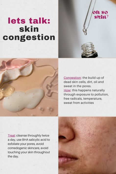 Lets Talk! 🌸 Today we are discussing skin congestion, what it is, how it happens and how to treat it. Have you ever had congested skin? #skincare #skincongestion #cloggedpores #treatskincongestion #treatcloggedpores Congested Skin, Lets Talk, Skin Skincare, Clogged Pores, Skincare Tips, Touching You, Free Radicals, Salicylic Acid, Have You Ever