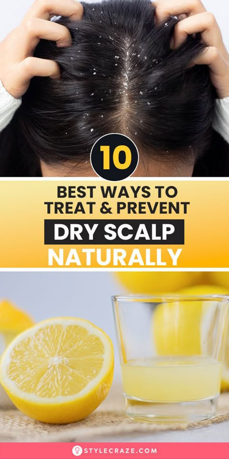 If you feel like scratching your head all the time, chances are you may have a dry scalp. We all develop a dry scalp at some point. Be it lifestyle changes, a shift in the weather, or some chemical in your product, a dry scalp can develop due to several reasons. Remedies For Dry Scalp, Diy Hair Growth Spray, Dry Scalp Remedy, Hair Color Swatches, Scalp Cleanse, Hair And Skin Vitamins, Diy Hair Growth, Hair Growth Spray, Hair Scrub