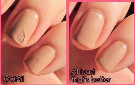 Idea to Fix a Smudged Nail Fix Nail Polish, Nail Art Matte, Nail Base Coat, Matte Nail Art, Pretty Nail Designs, Matte Nails, Diy Nails, Essie, Nail Tips