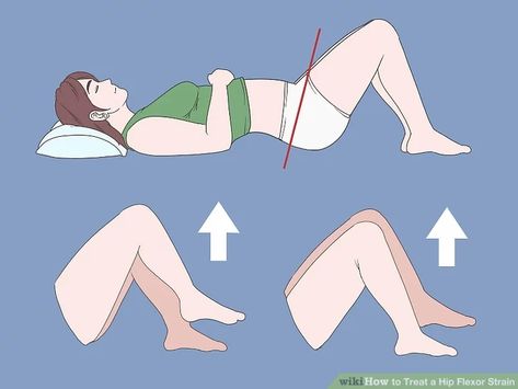 4 Simple Ways to Treat a Hip Flexor Strain - wikiHow Hip Flexor Strain, Hip Flexor Pain, Sore Hips, Turmeric Health, Spinal Nerve, Hip Flexors, Sciatic Nerve Pain, Hip Muscles, Healthy Teas