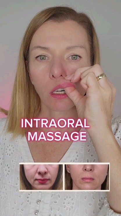 Natalia Gigengak | Natural Face Rejuvenation | 🔥REDUCE NASOLABIAL FOLDS🔥 The main causes of nasolabial folds 👇 🔸The tension of mimic muscles of the central part of the face. 🔸Fat pads… | Instagram Get Rid Of Nasolabial Folds, Nasolabial Folds Get Rid Of, Frown Lines Around Mouth, Face Yoga Before And After, Get Rid Of Marionette Lines, Jowl Exercises, Malar Bags, Platysma Muscle, Lines Around Mouth