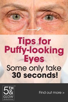 Saggy Eyes, Eye Bag Remedies, Saggy Eyelids, Puffy Eyes Remedy, Wrinkle Remedies, Skin Care Wrinkles, Spots On Face, Healthy Eyes, Face Wrinkles